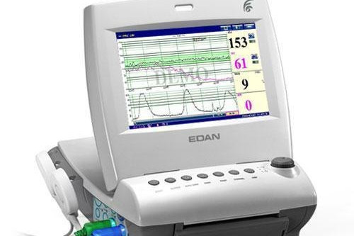 Cardiotocograph. Credit: Edan