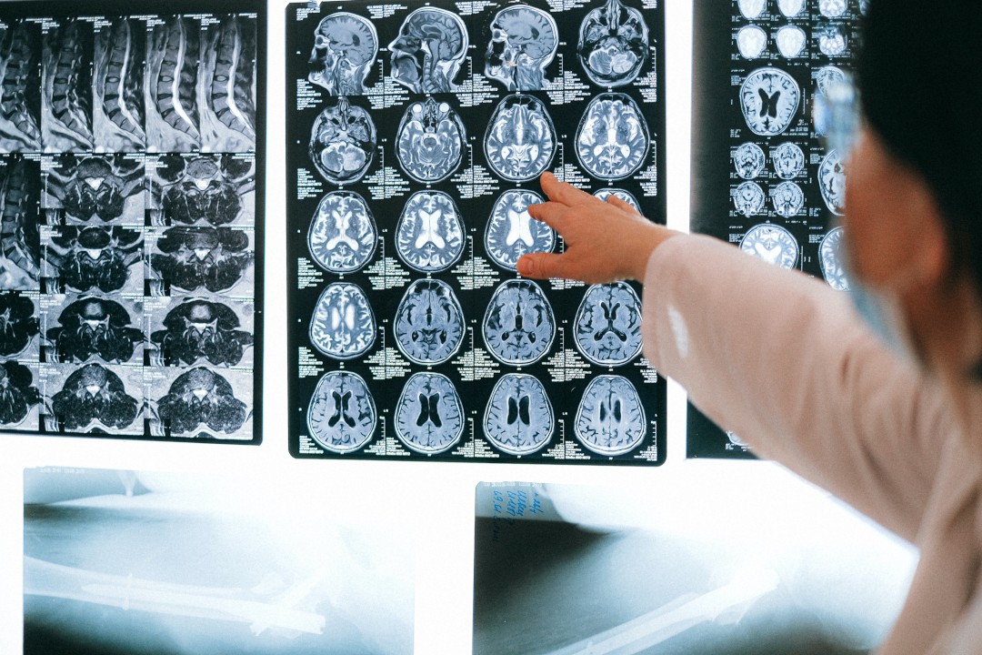 MRI image